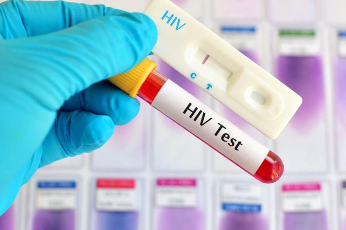 vih_test_250_jpg_711_473_1